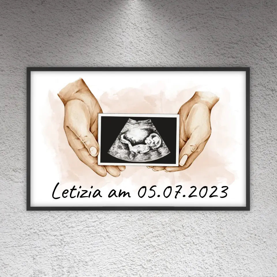 dein Foto Ultraschallbild auf Leinwand - Individuelle Leinwand