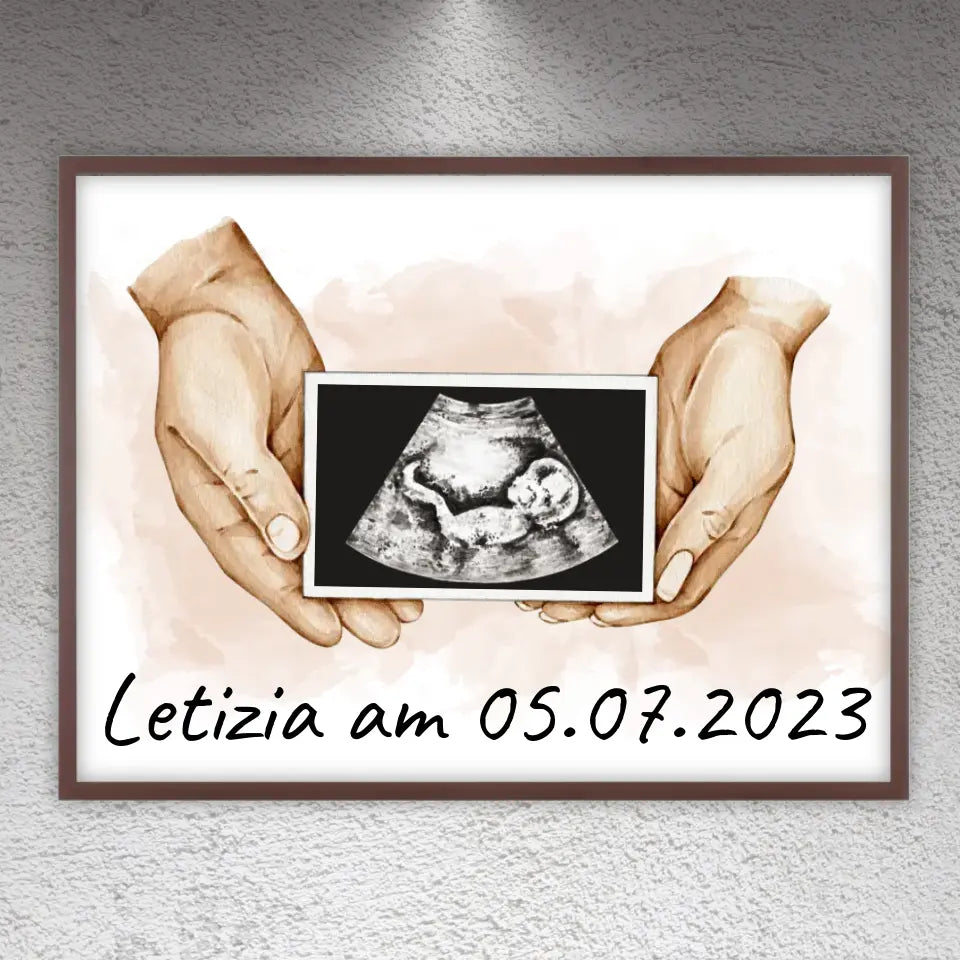dein Foto Ultraschallbild auf Leinwand - Individuelle Leinwand
