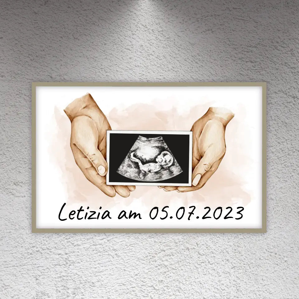 dein Foto Ultraschallbild auf Leinwand - Individuelle Leinwand