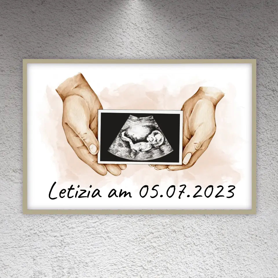 dein Foto Ultraschallbild auf Leinwand - Individuelle Leinwand
