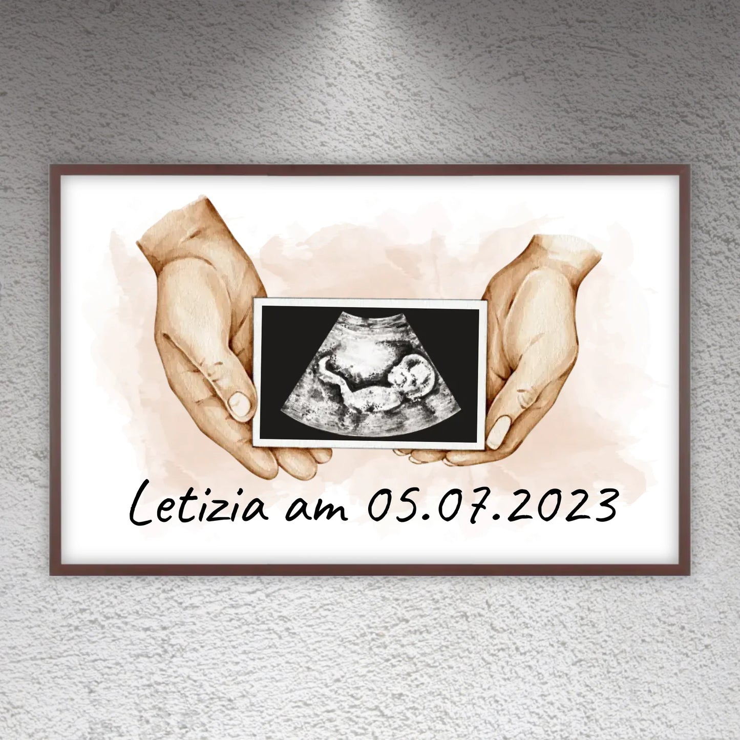 dein Foto Ultraschallbild auf Leinwand - Individuelle Leinwand | Personalize Palace