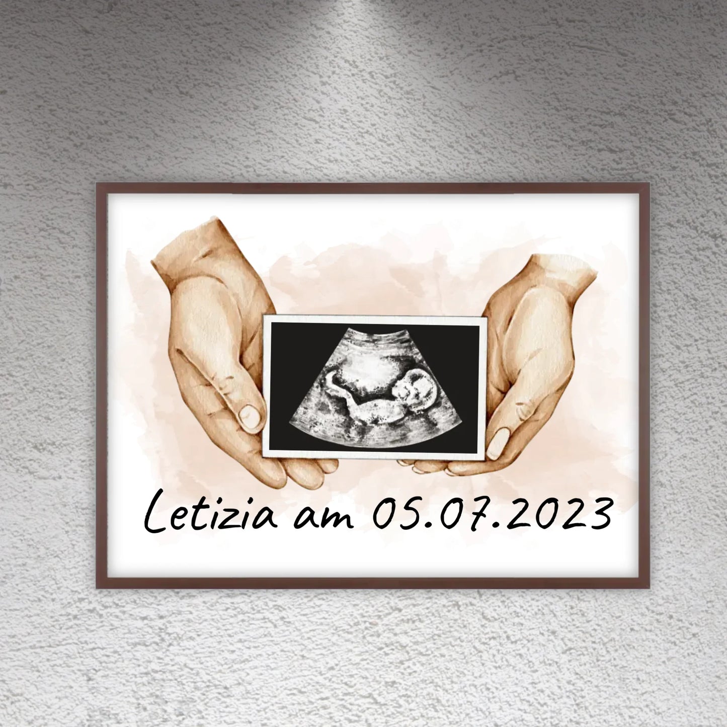 dein Foto Ultraschallbild auf Leinwand - Individuelle Leinwand | Personalize Palace