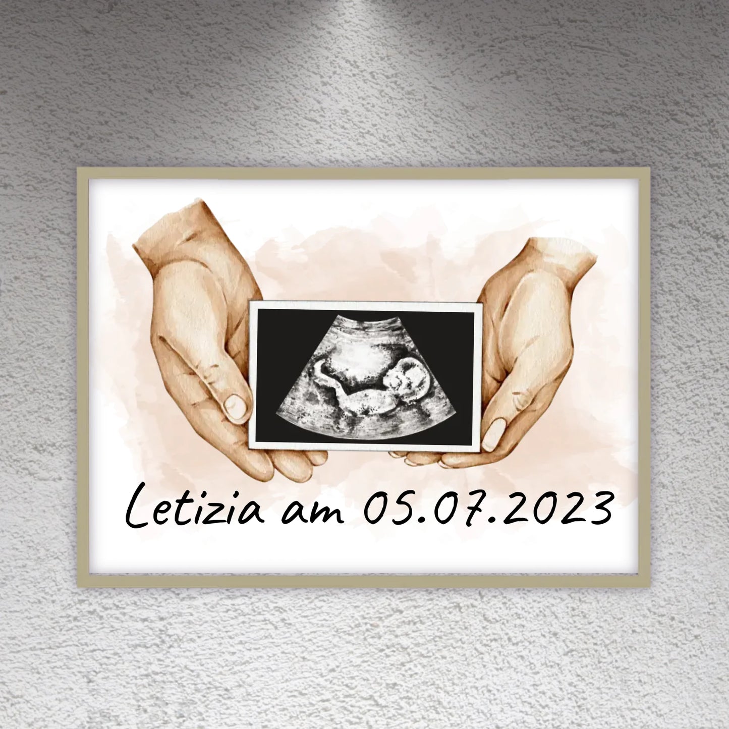 dein Foto Ultraschallbild auf Leinwand - Individuelle Leinwand