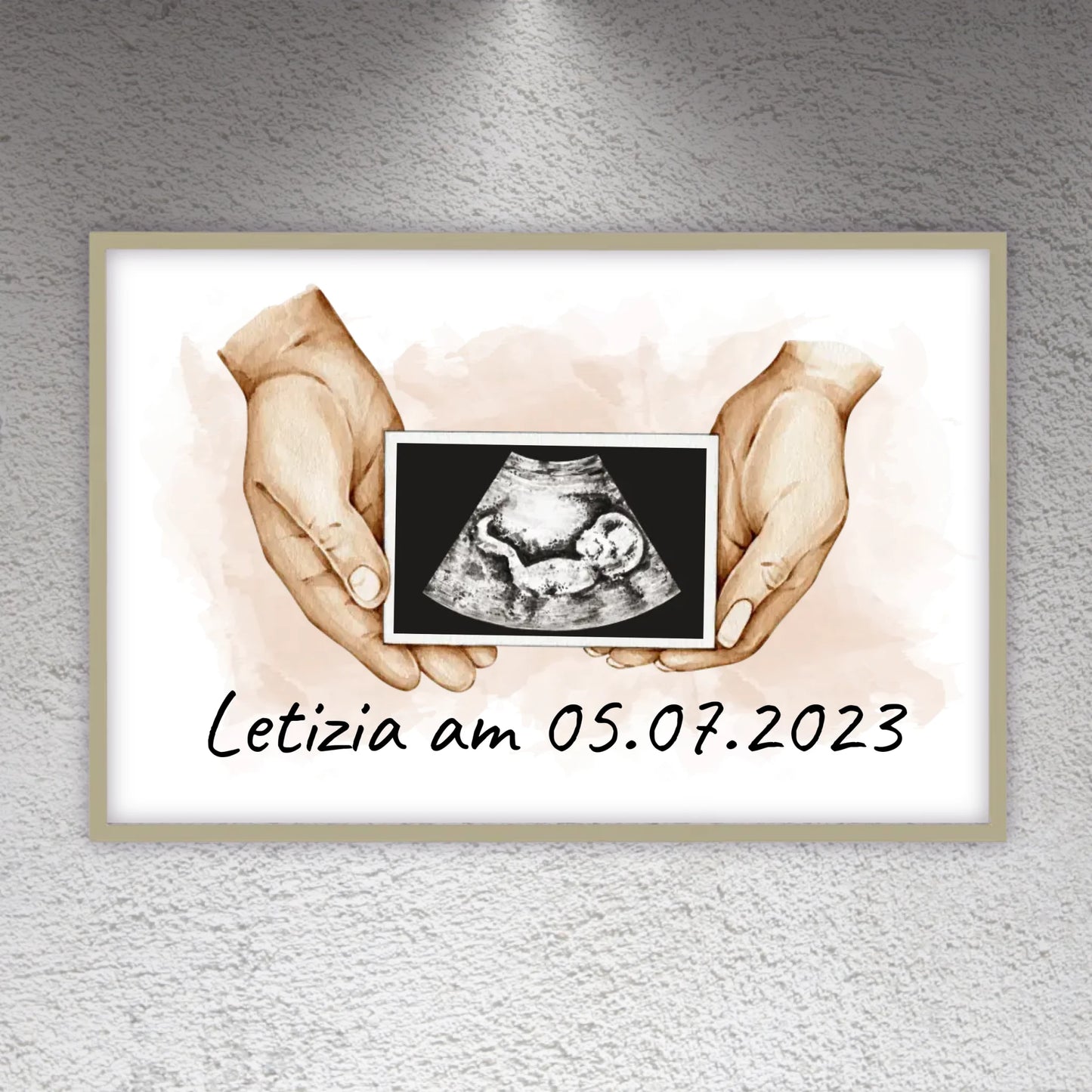 dein Foto Ultraschallbild auf Leinwand - Individuelle Leinwand