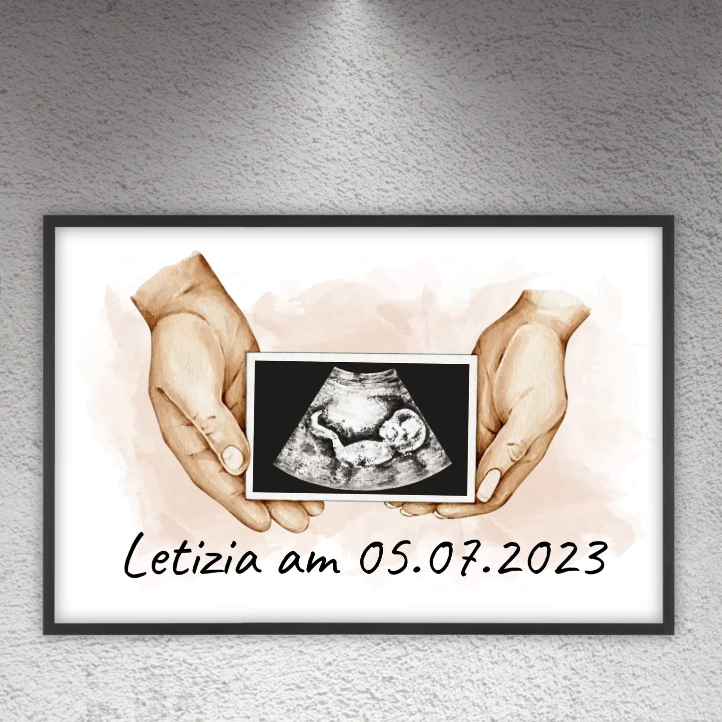 Your photo ultrasound image - Individual picture with gallery frame