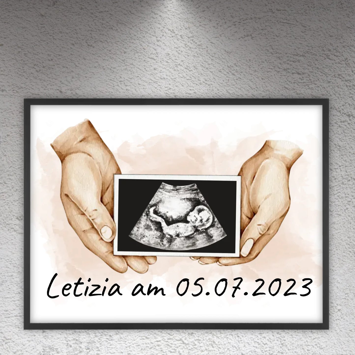 Your photo ultrasound image - Individual picture with gallery frame
